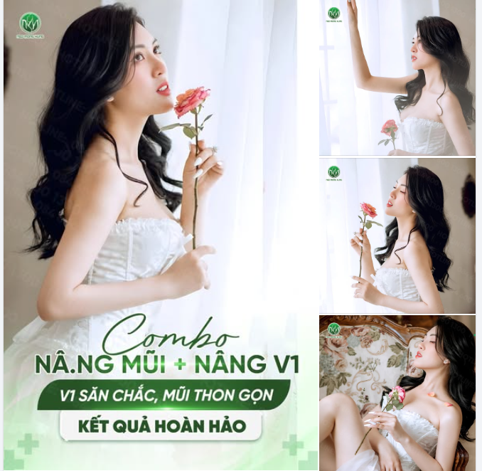 NHAN SẮC RẠNG RỠ SAU THỰC HIỆN COMBO NÂNG V1 VÀ NÂNG MŨI