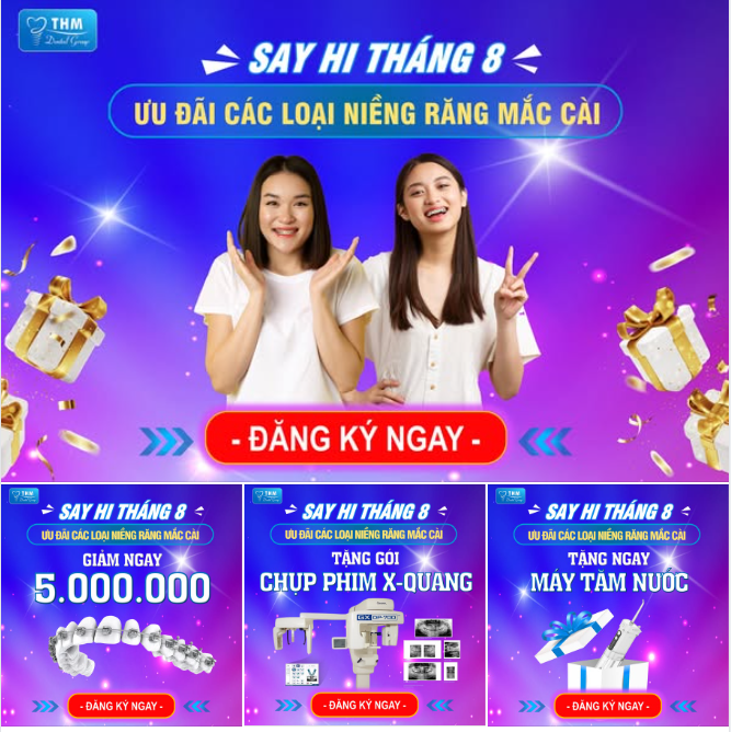SAY HI THÁNG 8 – ƯU ĐÃI NIỀNG RĂNG SIÊU HẤP DẪN