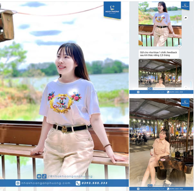 Tháo niềng xong chăm chụp ảnh hẳn, đồng niềng thấy đúng thả tim cho bạn Bích nha 