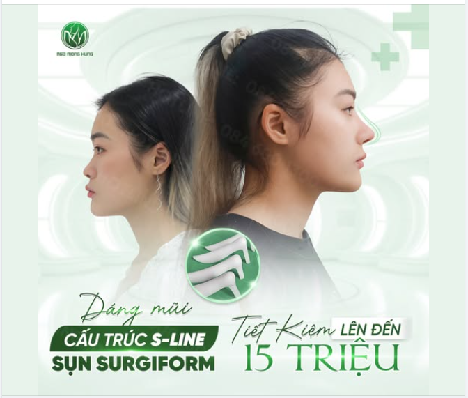 NÂNG MŨI CẤU TRÚC S-LINE VÀ SỤN SURGIFORM - TIẾT KIỆM LÊN ĐẾN 15 TRIỆU