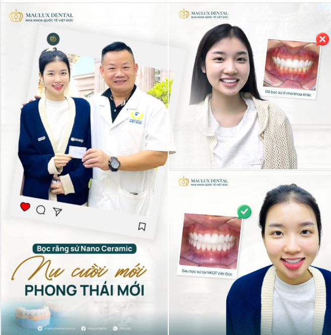 NỤ CƯỜI CŨNG CẦN ĐƯỢC CHĂM SÓC LẠI