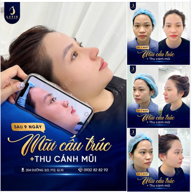 THAY ĐỔI MỘT CHÚT - KHÁC BIỆT RẤT NHIỀU