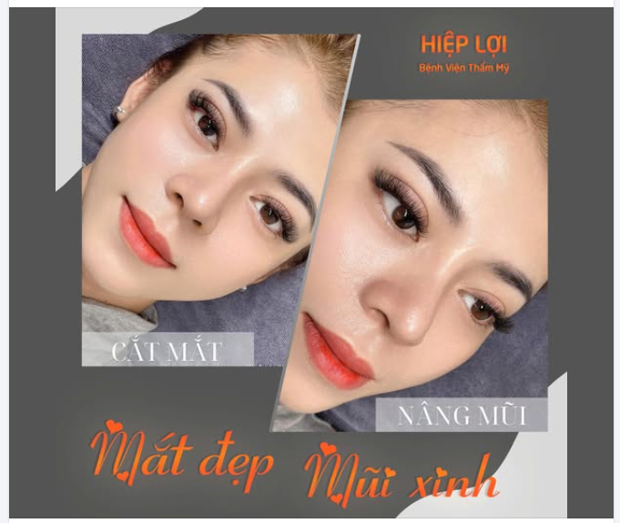 Mắt đẹp – Mũi xinh, vẻ đẹp hoàn hảo nhà Hiệp Lợi!