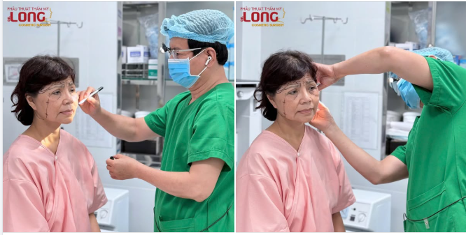 KHÁCH HÀNG CẦN LÀM GÌ SAU PHẪU THUẬT CĂNG DA MẶT?