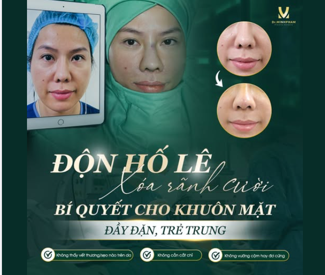 TẠI SAO ĐỘN HỐ LÊ LÀ GIẢI PHÁP XOÁ RÃNH CƯỜI TỐT NHẤT HIỆN NAY?