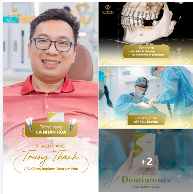 TỪ BỎ "THUỐC LÀO" ĐỂ BẮT ĐẦU HÀNH TRÌNH KHÔI PHỤC NỤ CƯỜI KHỎE MẠNH