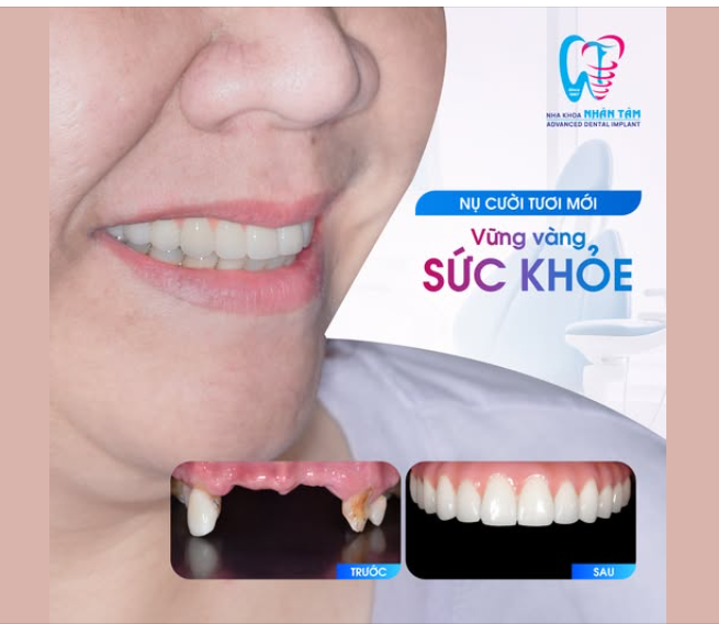 NỤ CƯỜI TƯƠI MỚI - SỨC KHỎE VỮNG VÀNG