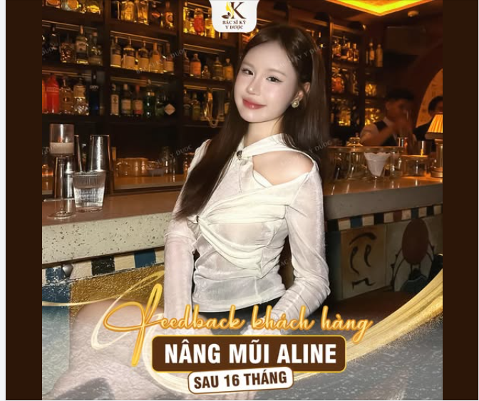 Feedback khách hàng sau 16 tháng nâng mũi ALINE