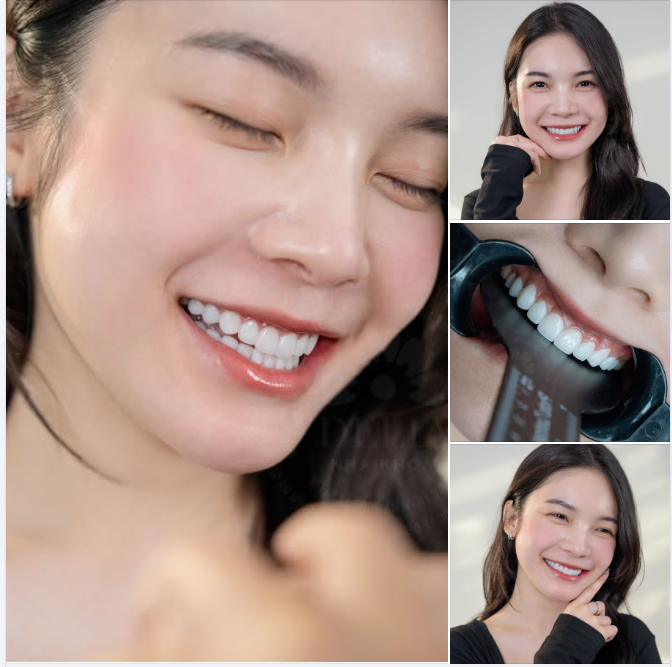 Ai bảo răng sứ là kém tự nhiên?