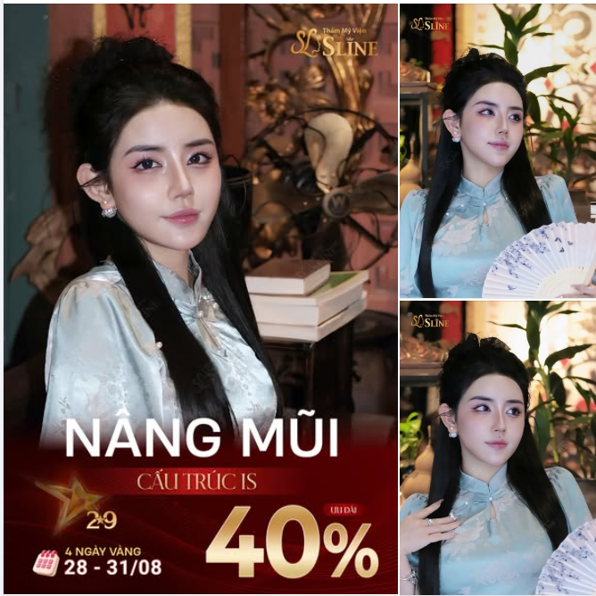 NÂNG MŨI CẤU TRÚC IS – THIẾT KẾ DÁNG MŨI THEO TỪNG KHUÔN MẶT