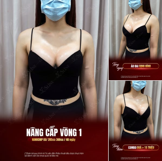 HÀNH TRÌNH NÂNG CẤP VÒNG 1 – CHỌN SỰ TINH TẾ