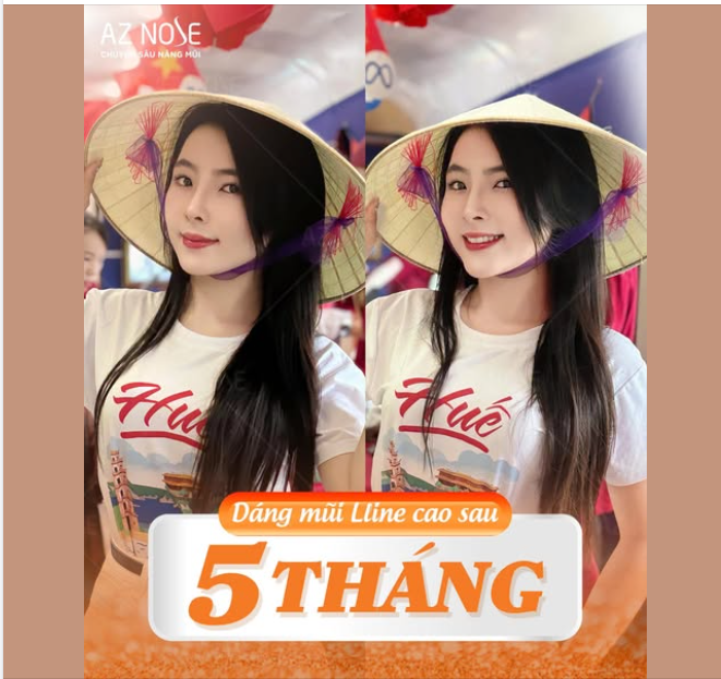 Dáng mũi Lline cao - lựa chọn hoàn hảo dành cho các cô nàng cá tính, hiện đại, yêu thích vẻ đẹp phương Tây