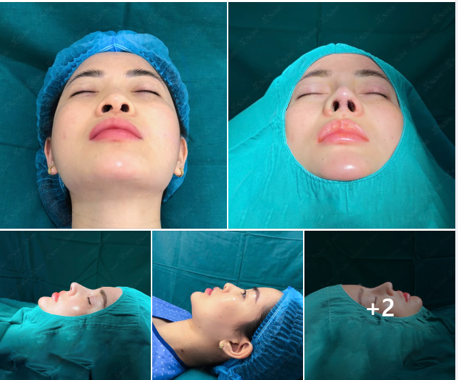 TÁI TẠO VẺ ĐẸP – NÂNG TẦM TỰ TIN