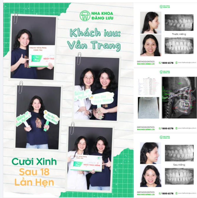CƯỜI XINH SAU 18 LẦN HẸN