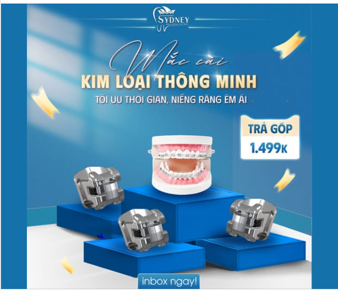 MẮC CÀI KIM LOẠI THÔNG MINH - TỐI ƯU THỜI GIAN, NIỀNG RĂNG ÊM ÁI