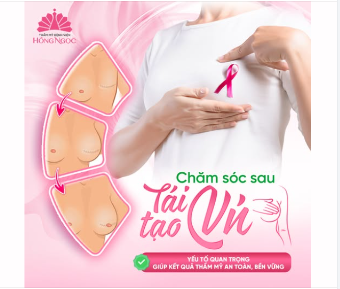 Chăm sóc sau tái tạo vú – Yếu tố quyết định để kết quả bền đẹp, an toàn