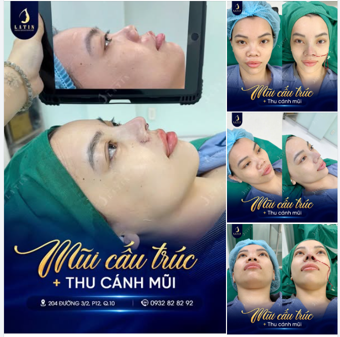 Từ tự ti đến tự tin – chỉ sau một lần thay đổi
