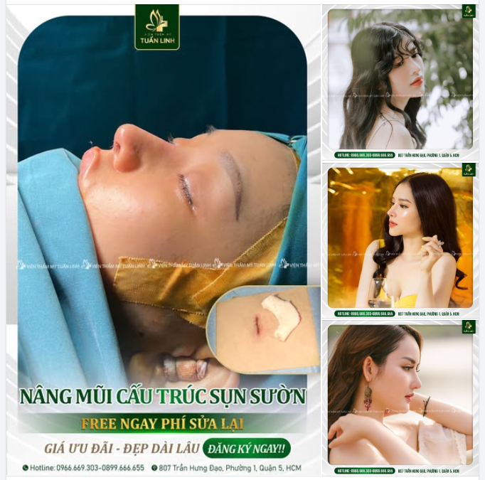 NÂNG MŨI CẤU TRÚC SỤN SƯỜN - ĐẸP HOÀN HẢO - FREE NGAY PHÍ SỬA LẠI!!