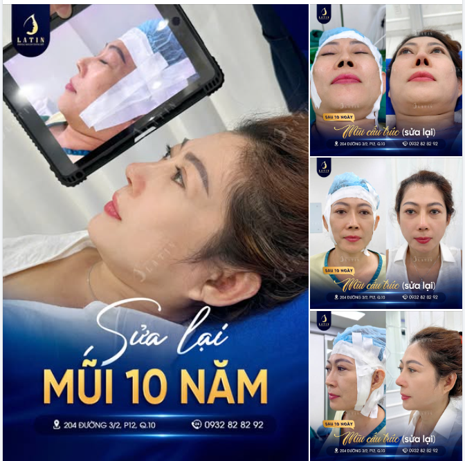 Nâng cấp công nghệ – Thăng hạng diện mạo