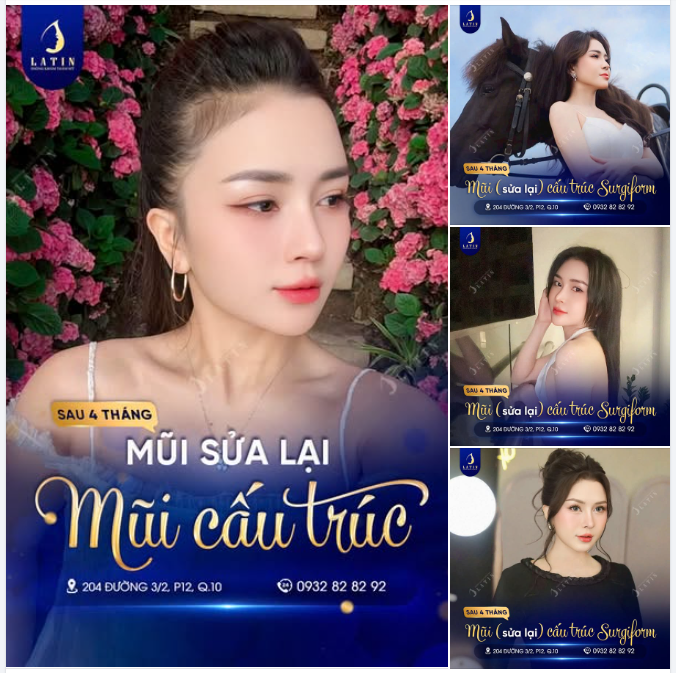 TÁI SINH CHIẾC MŨI – THAY ĐỔI THẦN THÁI