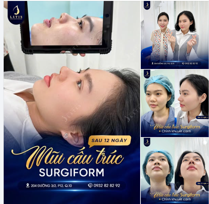 DIỄN VIÊN THẢO TRĂM TIN TƯỞNG CHỌN LATIN TU SỬA DÁNG MŨI