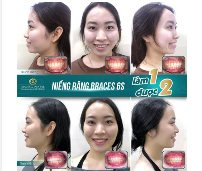 Từ “nụ cười ngại ngùng” → “góc nghiêng thần thánh”