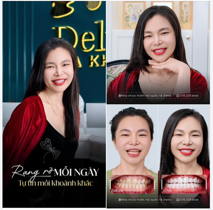 Làm đẹp không chỉ để đẹp hơn, mà còn để yêu thương bản thân nhiều hơn
