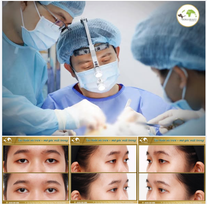 Đôi mắt không chỉ là điểm nhấn thẩm mỹ mà còn thể hiện thần thái của mỗi người.