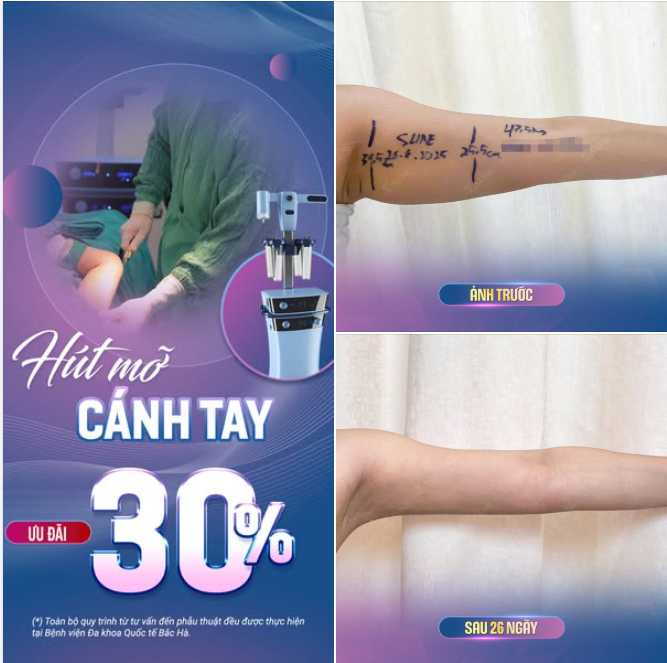 CÁNH TAY GỌN GÀNG – TỰ TIN DIỆN MỌI TRANG PHỤC.