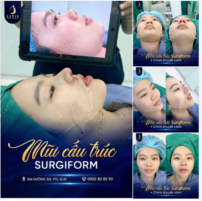 TỪNG PHÂN VÂN, TỪNG ĐẮN ĐO... GIỜ THÌ ĐÃ QUÁ HÀI LÒNG