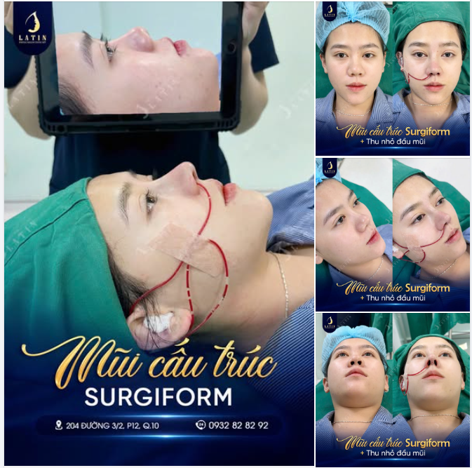 ĐẦU MŨI THON GỌN - GƯƠNG MẶT ĐẸP TRỌN
