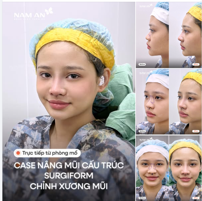 Gen Z hành trình update visual