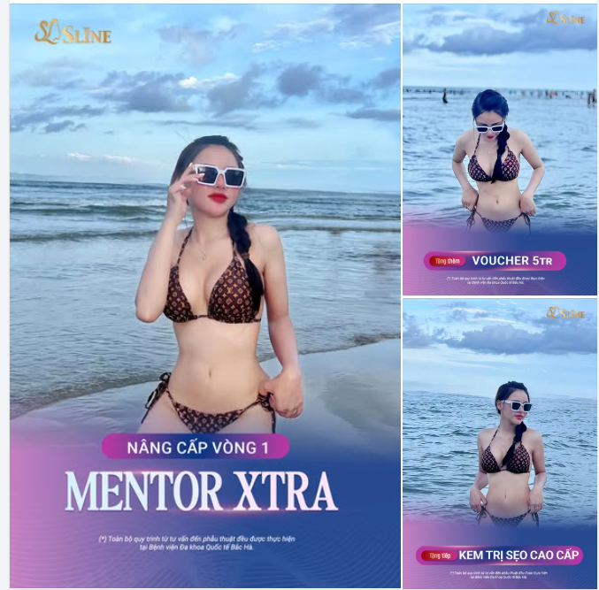 NÂNG CẤP VÒNG 1 – MENTOR XTRA.