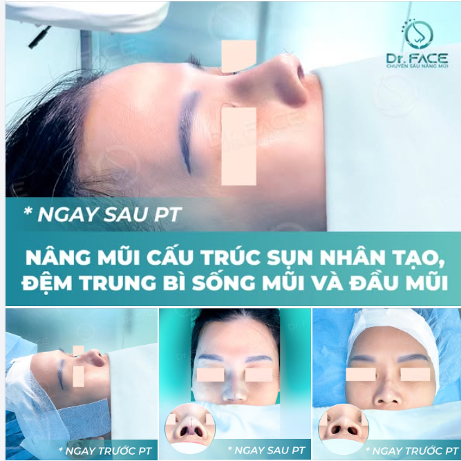 THÊM MỘT LẦN THAY ĐỔI, THÊM MỘT LẦN TỰ TIN