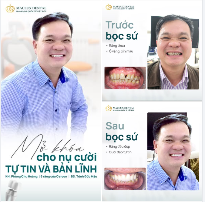 MỞ KHÓA NỤ CƯỜI - KHAI MỞ BẢN LĨNH