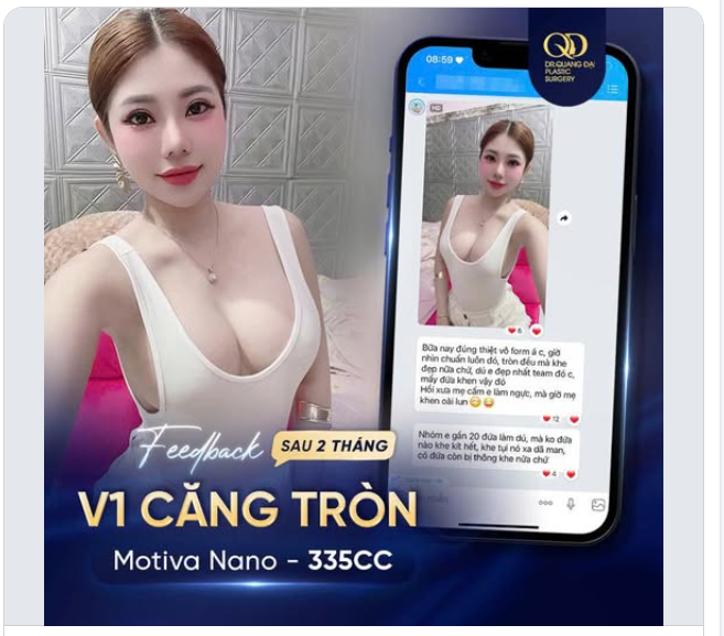 2 THÁNG SAU NÂNG CẤP VÒNG 1 - DIỆN MẠO THAY ĐỔI, TỰ TIN GẤP BỘI