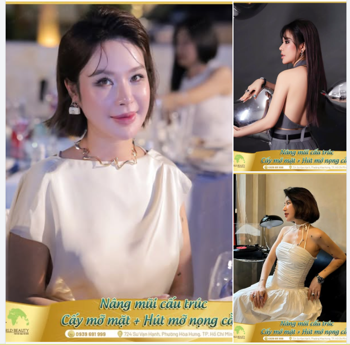 Nâng mũi cấu trúc Hút mỡ nọng cằm Cấy mỡ mặt Baby face