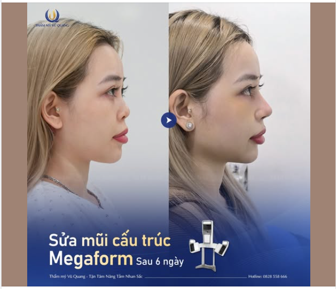 VẪN LÀ BẠN , NHƯNG LÀ PHIÊN BẢN HOÀN HẢO HƠN!