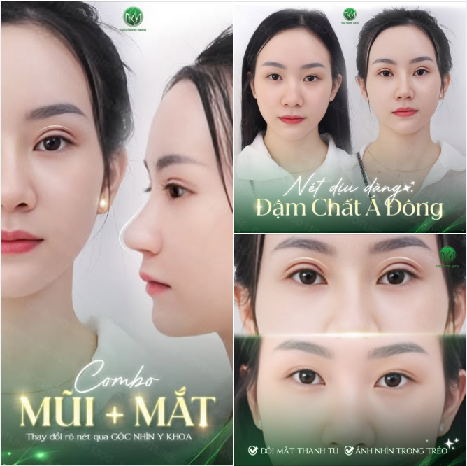 Lễ Lớn - Ưu đãi Khủng  Cơ hội sở hữu Combo mũi + mắt - Tiết kiệm lên đến 50%