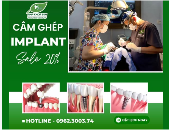 THÁNG 9 – ƯU ĐÃI ĐẶC BIỆT  CẮM GHÉP IMPLANT – SALE 20%
