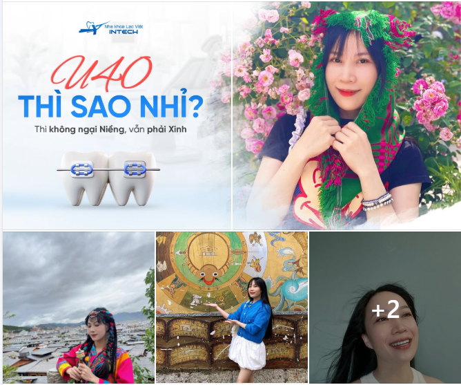 U40 NIỀNG RĂNG THÌ SAO NHỈ?