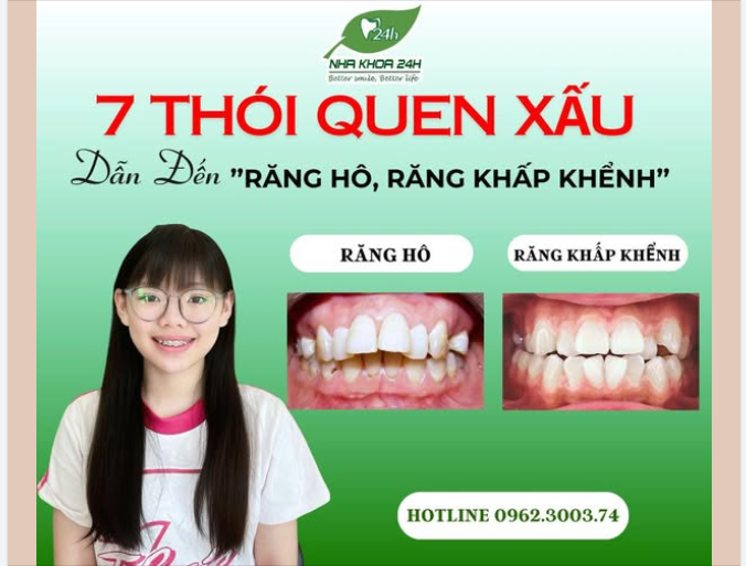 7 Thói quen xấu khiến răng hô – răng khấp khểnh