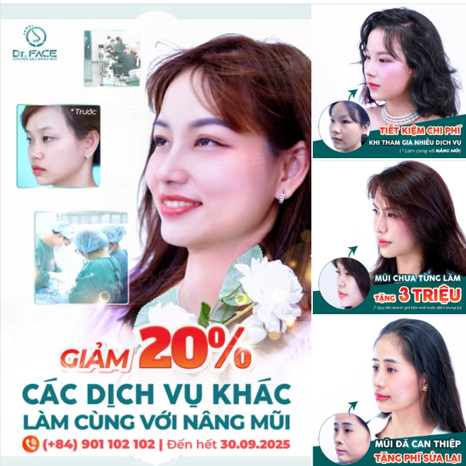 GIẢM 20% GIÁ DỊCH VỤ KHÁC KHI LÀM CÙNG NÂNG MŨI