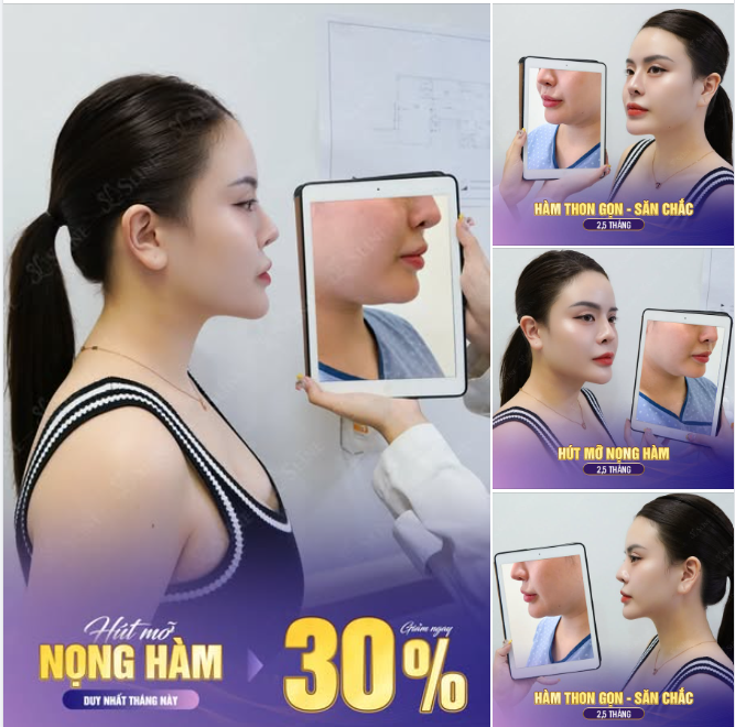 GỌN GƯƠNG MẶT – TỰ TIN TỎA SÁNG