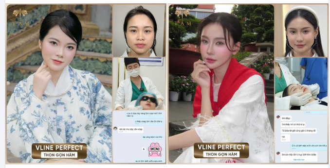 Cùng Phòng khám hái quả ngọt sau khi trải nghiệm liệu trình Vline Perfect của khách iu nhé mọi người.