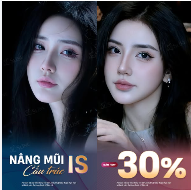 NÂNG MŨI CẤU TRÚC IS  "Thiết kế dáng mũi chuẩn theo từng khuôn mặt"