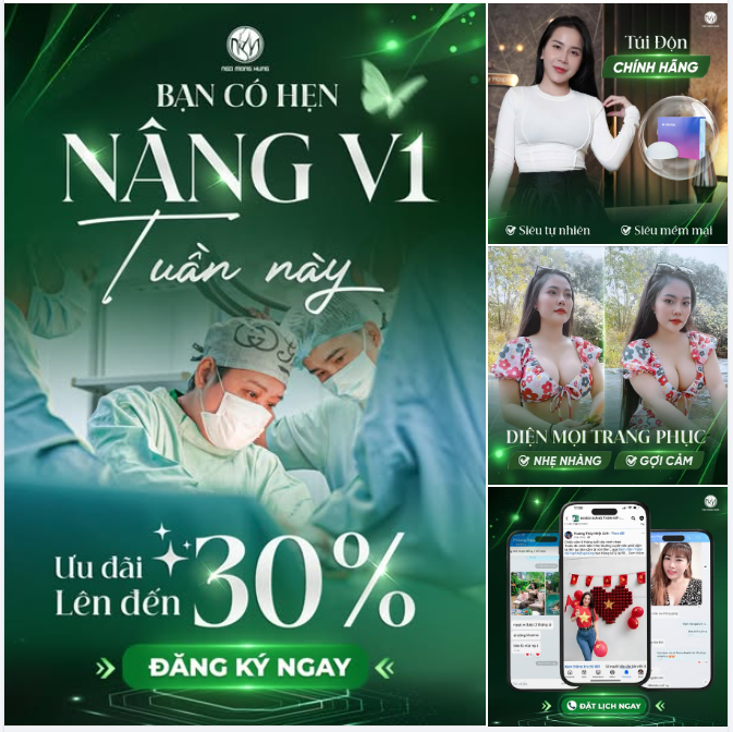 Bạn có hẹn nâng V1 tuần này - Ưu đãi lên đến 30%