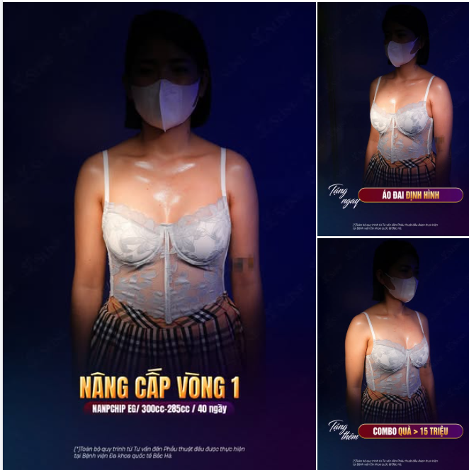 NÂNG CẤP VÒNG 1 – NANOCHIP EG