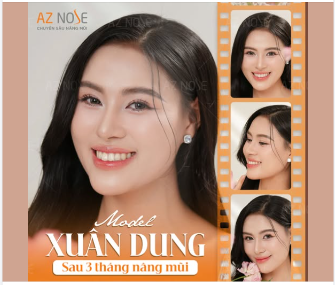 Thần thái tự tin, rạng rỡ của Top 10 THE TVFACE 2025 - Xuân Dung sau 3 tháng nâng mũi