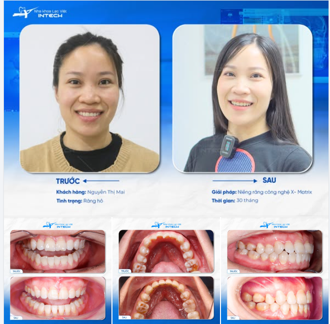 Phụ nữ không nên có muộn phiền  Phụ nữ chỉ nên có nhiều tiền và xinh.